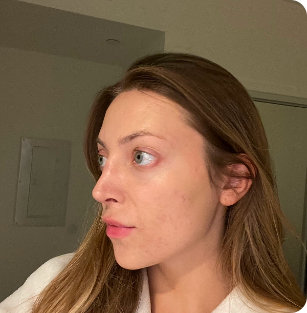 Calmer, More Even-Toned Skin