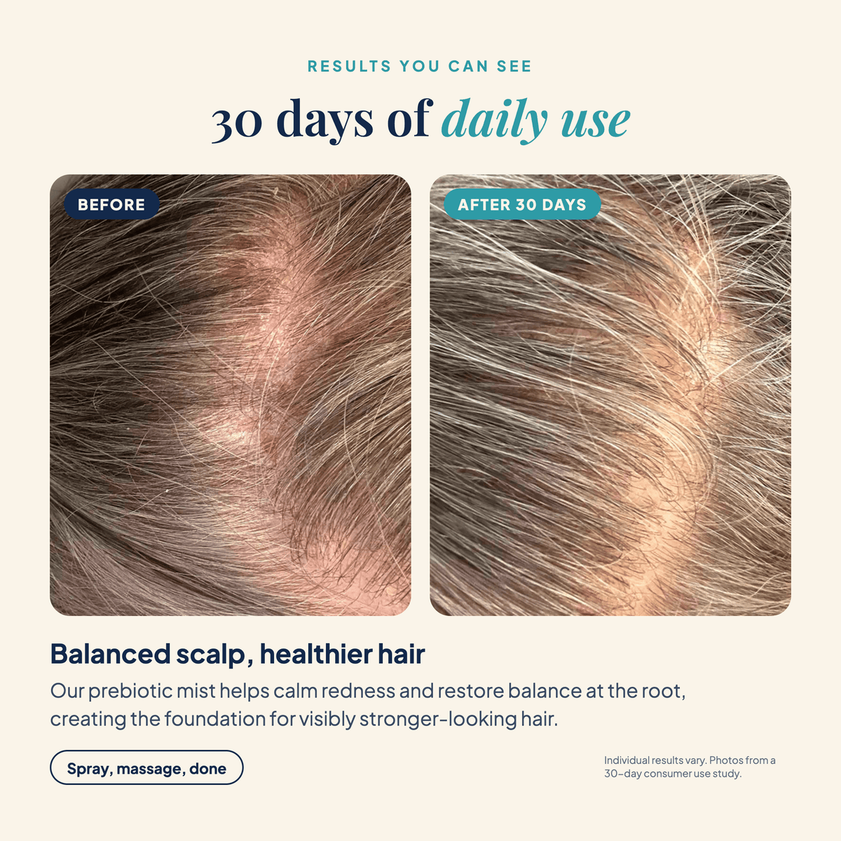 Scalp Mist results for a calmer, more balanced scalp